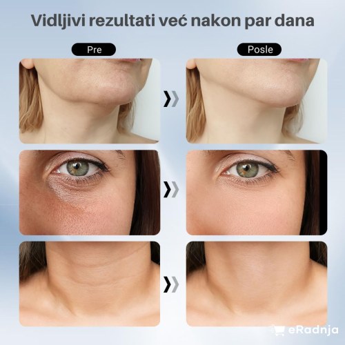 Slika opis 10