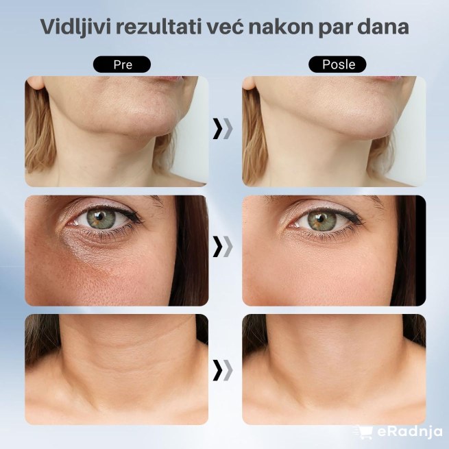 Slika 4